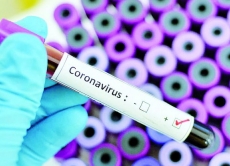 Перший випадок коронавірусу в Україні: ситуація під контролем медиків та Уряду